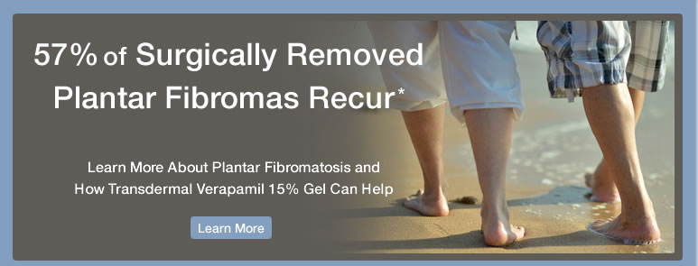 Plantar Fibromatosis